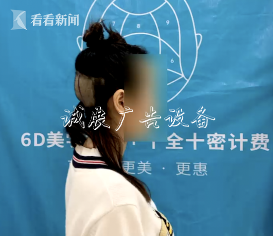 美女被剃禿頭 卻因抑指路牌郁癥被告知不能做植發(fā)手術(shù)